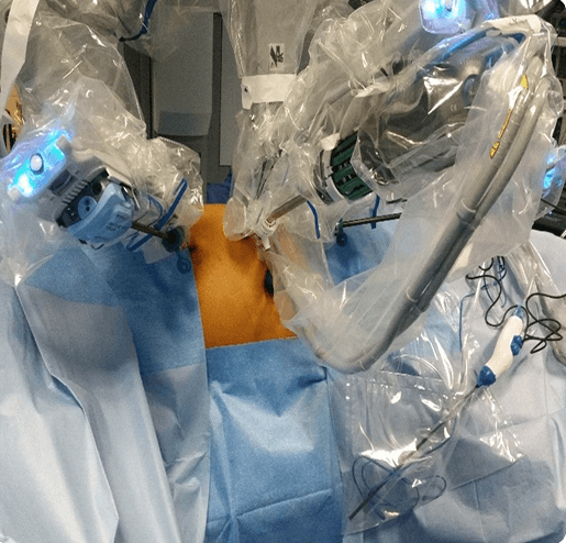 Robotic-assisted procedure setup